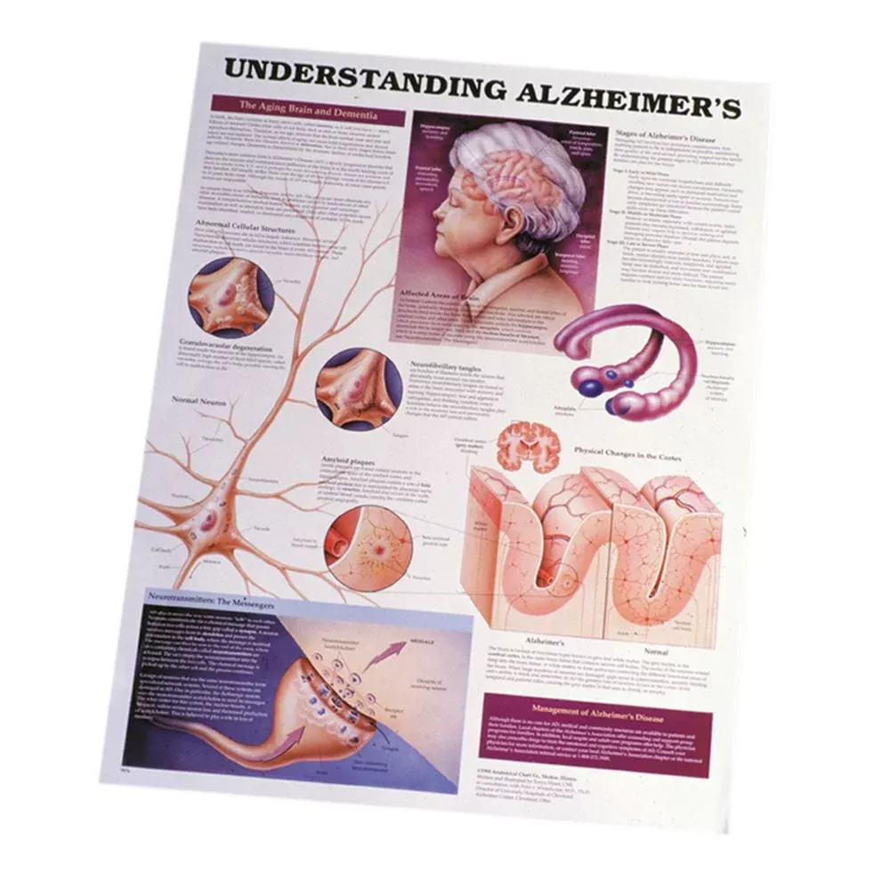 Alimed Understanding Alzheimer's Chart Understanding Alzheimer's - 80445