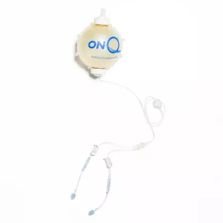 Avanos Medical Sales LLC Elastomeric Pump ON-Q* Gravity Disposable 270 mL Capacity 270 mL Volume 4 mL / Hr. Flow Rate - Case of 5 - PM025-A-CS