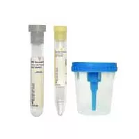 BD 364956 - BD Vacutainer Urine Collection Kit with Screw-Cap Cup