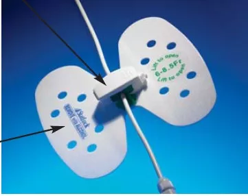 BD VUPD68 - Catheter / Line Securement Device Statlock Universal