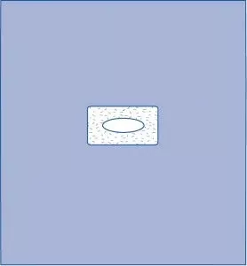 Medline Adherent Window Drape - Adherent Window Sheet, Sterile, 41" x 45" - DYNJP2493