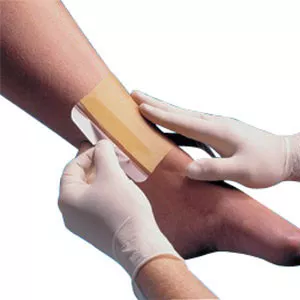Smith & Nephew 483200 - Hydrocolloid Dressing Replicare 6 X 6 Inch Square Sterile