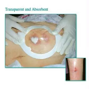 Tegaderm Clear Absorbent Acrylic Dressing 3" X 3-3/4" Oval- 1 Each